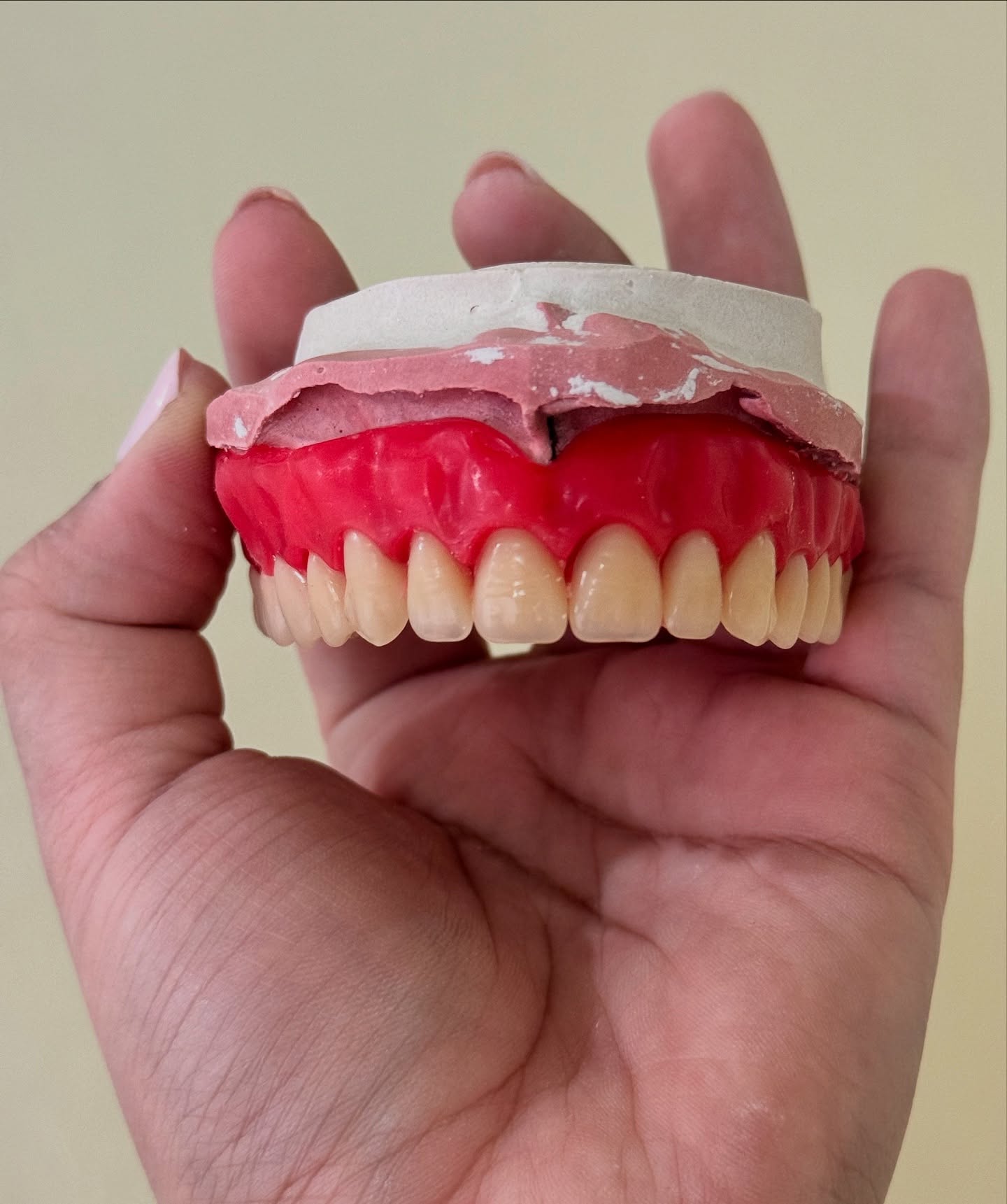 Paciente mostrando sonrisa después de limpieza dental